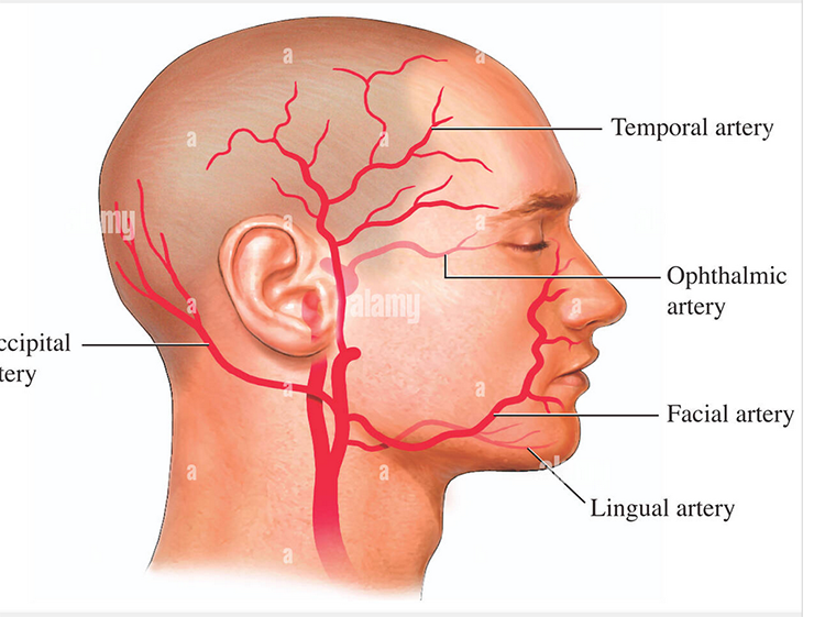 arterie-testa.png